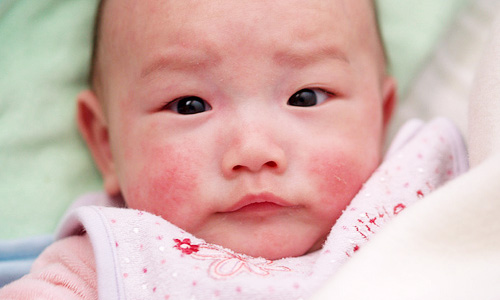 Một số bệnh nguy hiểm đối với trẻ sơ sinh khi dùng máy lạnh Một số bệnh nguy hiểm đối với trẻ sơ sinh khi dùng máy lạnh